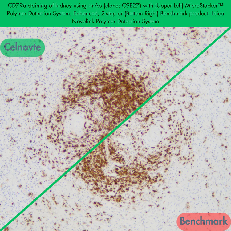 MicroStacker™ Polymer Detection System, Enhanced, 2-step
