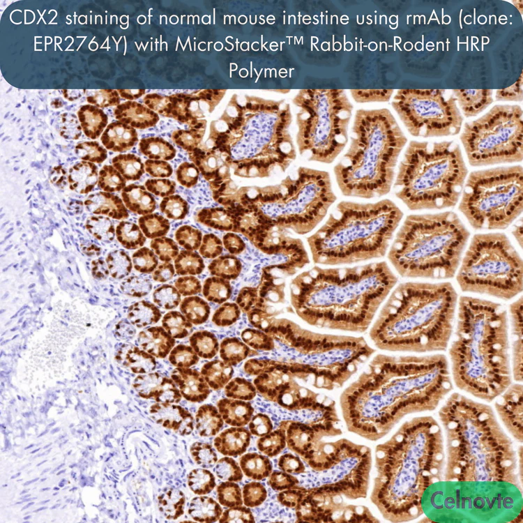 MicroStacker™ Rabbit-on-Rodent HRP Polymer